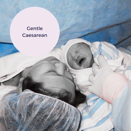 gentle caesarean birth